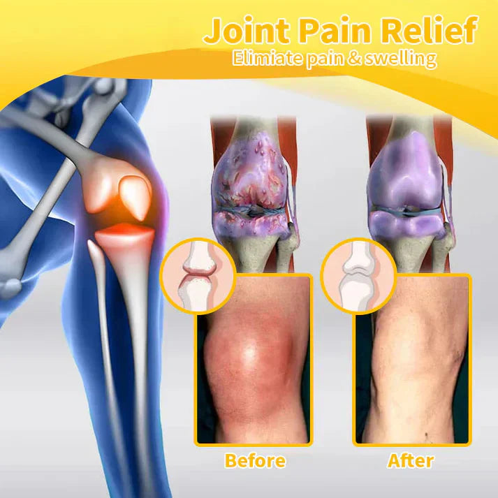 Official Store: TLOPA® Bee-Venom Pain-Relief Bone Healing Cream👨‍⚕️USA Osteopathic Medical Association (AAOS) Approved(Reducing joint swelling, pain, stiffness, redness, warmth, soreness, and joint fatigue)