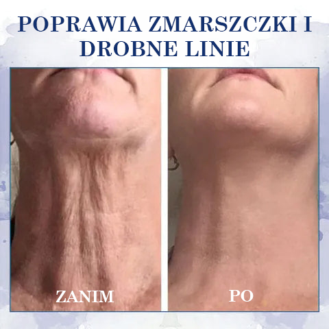 🔥 Ostatni dzień - 60% ZNIŻKI🔥Fubsta® Zaawansowany krem ujędrniający i redukujący zmarszczki: przywróć elastyczność skóry