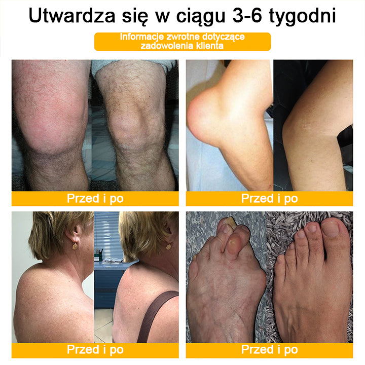 [🏆 Za pobraniem 🏆]💎Lotmay™ krem z jadem pszczelim do zaawansowanej terapii stawów i kości (ekstrakt z pszczoły nowozelandzkiej, specjalistyczny na schorzenia ortopedyczne i bóle stawów)💎