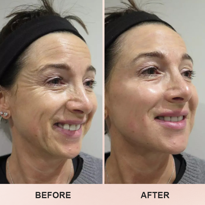 LIMETOW™ Anti-Wrinkle Stick