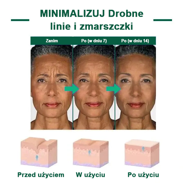 🌿💝Ostatni dzień promocji 60% Zniżki - Fubsta™ Serum odmładzające ujędrniające skórę🔥