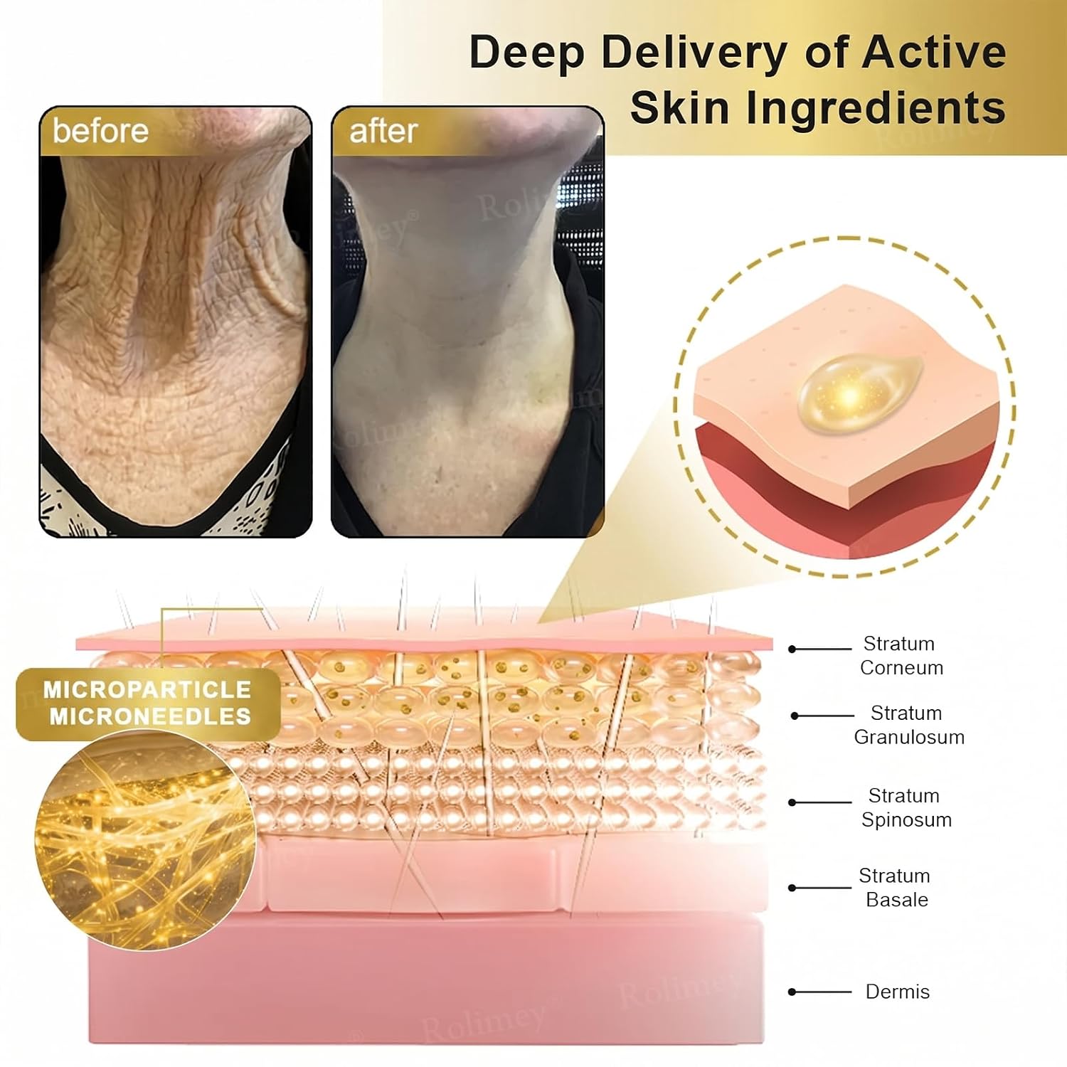 Collagen Fullerene Neck Cream, 2026 New Advanced Firming & Wrinkle-Reducing Cream with Collagen Peptides, Moisturizing & Pore Minimizer, Natural Anti-Wrinkle Serum for All Skin Types