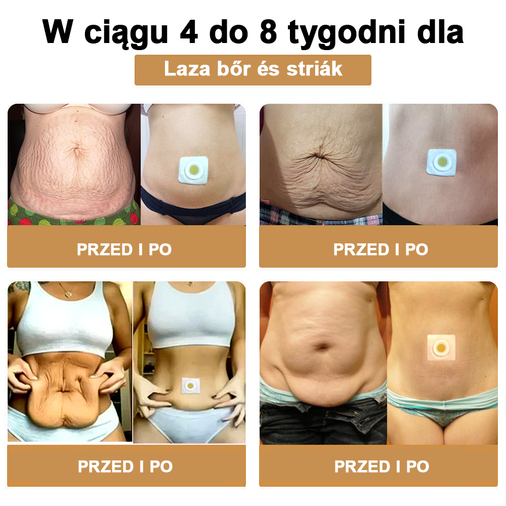 🐝AFGAFG™ Plaster wyszczuplający z drenażem limfatycznym na bazie jadu pszczelego 🔥Ograniczony czas 60% zniżki🔥(nadaje się do użytku przez osoby w każdym wieku)🔥