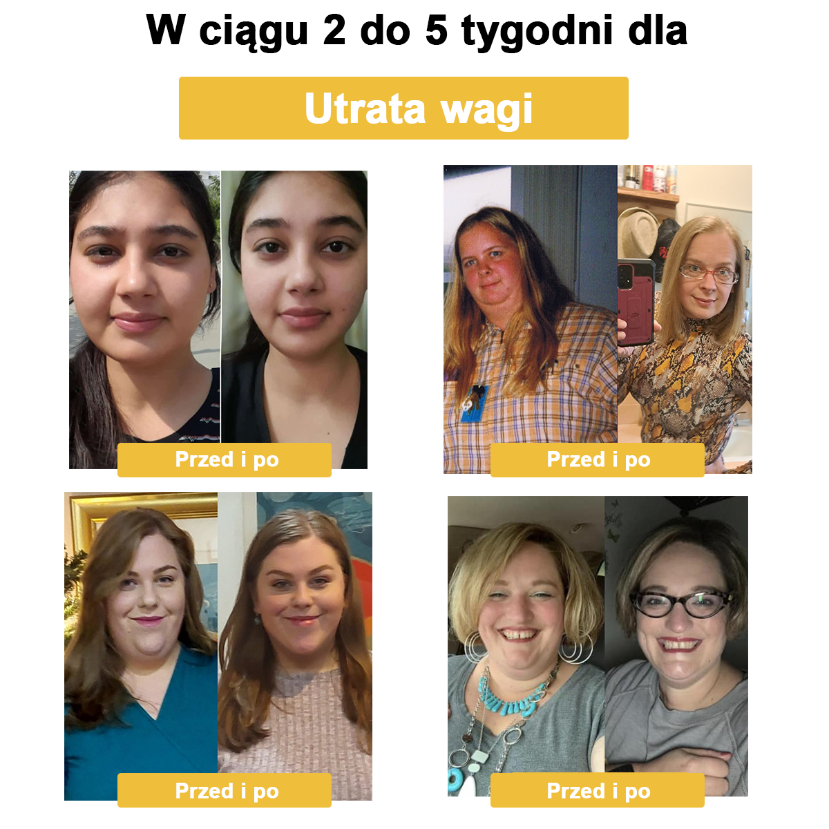 💝STDEI™ Krople do regeneracji i detoksykacji jamy brzusznej z jadem pszczelim（Dla wszystkich problemów z otyłością i limfą）