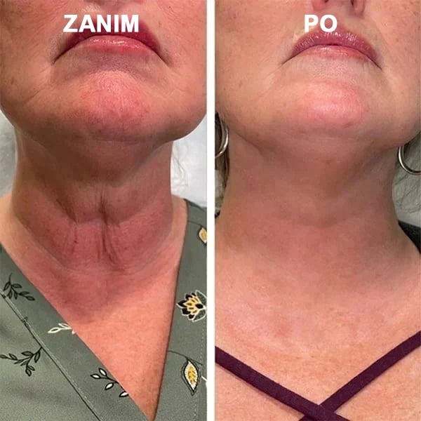 🌿💝Ostatni dzień promocji 60% Zniżki - Fubsta™ Serum odmładzające ujędrniające skórę🔥