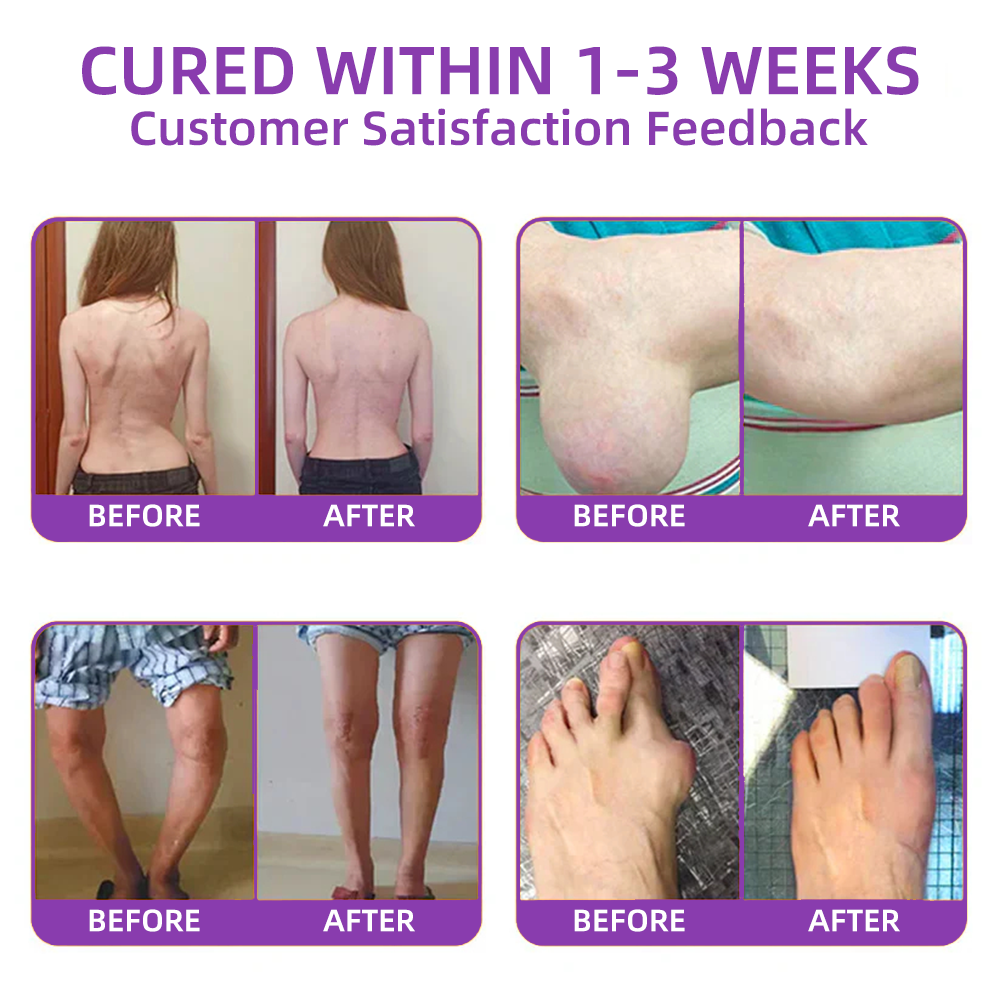 𝐎𝐟𝐟𝐢𝐜𝐢𝐚𝐥 𝐒𝐭𝐨𝐫𝐞: 𝐓𝐋𝐎𝐏𝐀® 𝑺𝒉𝒂𝒓𝒌 𝑪𝒂𝒓𝒕𝒊𝒍𝒂𝒈𝒆 𝑷𝒂𝒊𝒏-𝑺𝒐𝒐𝒕𝒉𝒊𝒏𝒈 𝑩𝒐𝒏𝒆 𝑹𝒆𝒄𝒐𝒗𝒆𝒓𝒚 𝑮𝒆𝒍 👨‍⚕️𝑨𝒎𝒆𝒓𝒊𝒄𝒂𝒏 𝑨𝒄𝒂𝒅𝒆𝒎𝒚 𝒐𝒇 𝑶𝒓𝒕𝒉𝒐𝒑𝒂𝒆𝒅𝒊𝒄 𝑺𝒖𝒓𝒈𝒆𝒐𝒏𝒔 (𝑨𝑨𝑶𝑺) 𝒓𝒆𝒄𝒐𝒎𝒎𝒆𝒏𝒅 (5-𝗆𝗂𝗇𝗎𝗍𝖾 𝗉𝖺𝗂𝗇 𝗋𝖾𝗅𝗂𝖾𝖿, 𝟩 𝖽𝖺𝗒𝗌 𝗍𝗈 𝗋𝖾𝗌𝗍𝗈𝗋𝖾 𝗃𝗈𝗂𝗇𝗍 𝗆𝗈𝖻𝗂𝗅𝗂𝗍𝗒, 𝟦 𝗐𝖾𝖾𝗄𝗌 𝖿𝗈𝗋 𝖼𝗈𝗆𝗉𝗅𝖾𝗍𝖾 𝗁𝖾𝖺𝗅𝗂𝗇𝗀)