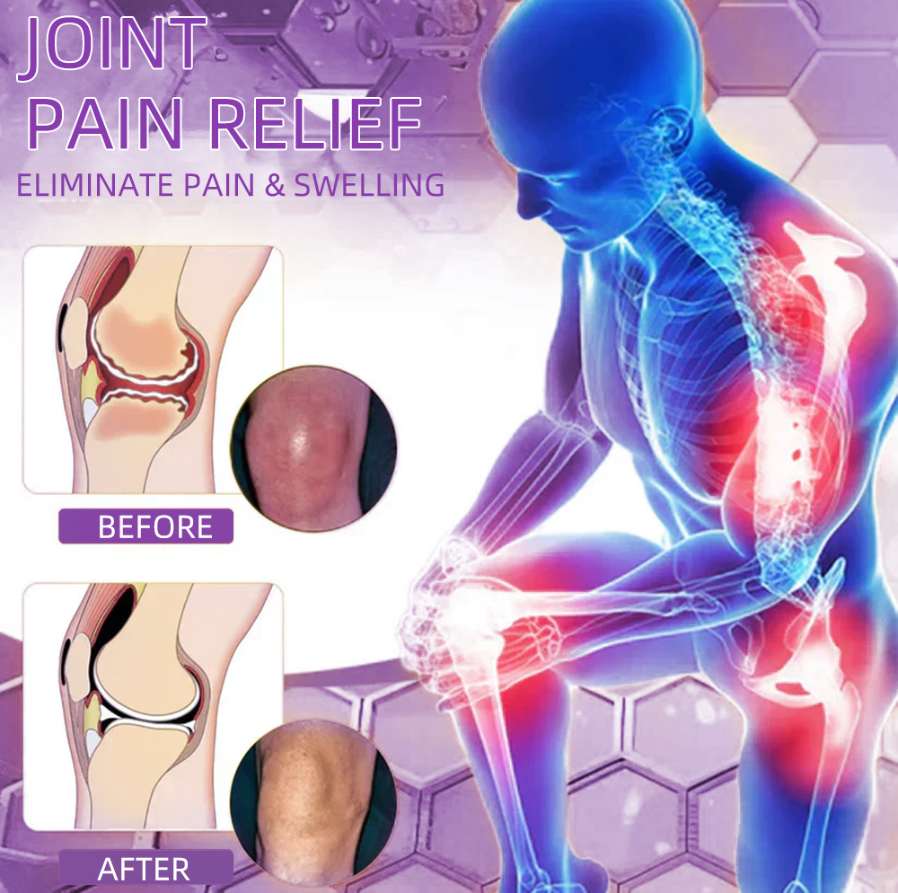 Official Store : TLOPA® Turmeric & Emu Oil Arthritis Soothing Pain Relief Massage Gel 👨‍⚕️ Approved by the American Academy of Orthopaedic Surgeons (AAOS)