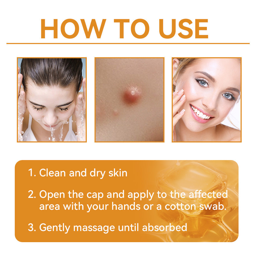 𝗧𝗟𝗢𝗣𝗔® Bee Venom Skin Treatment Cream – AAD Recommended👨‍⚕️(🔥LAST DAY 70% OFF)🔥
