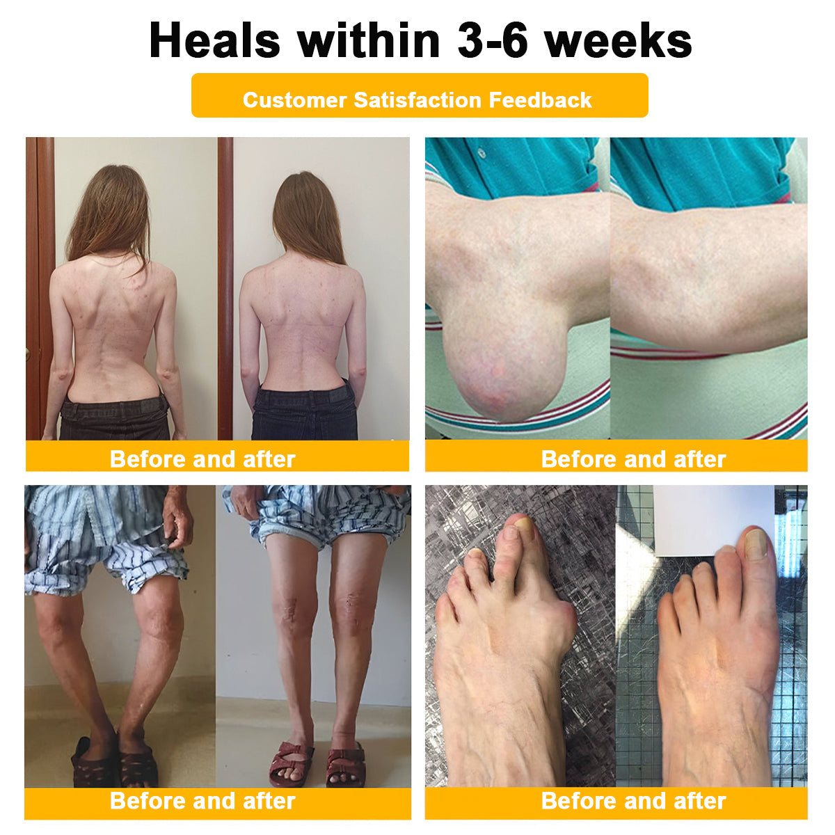 ADNOON™ Botulinum Toxin & Bee Venom Pain-Relief Bone Healing Cream