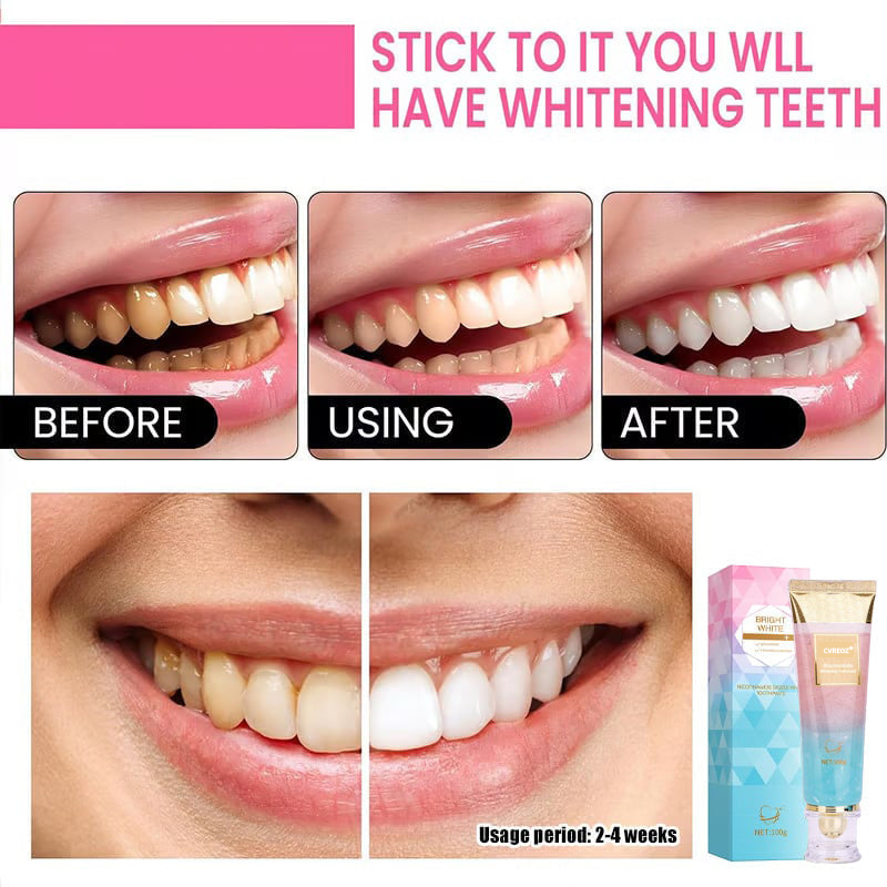 Cvreoz®Niacinamide Whitening Toothpaste-max