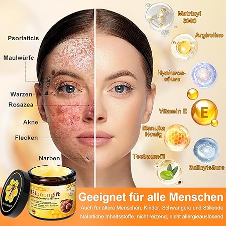 Bienengift Hautregenerationscreme, Professionelle Bienengift Creme, Ourlyard Bee Venom Hautregenerierende Creme, Bienengiftsalbe, Bienengiftcreme für alle Hauttypen