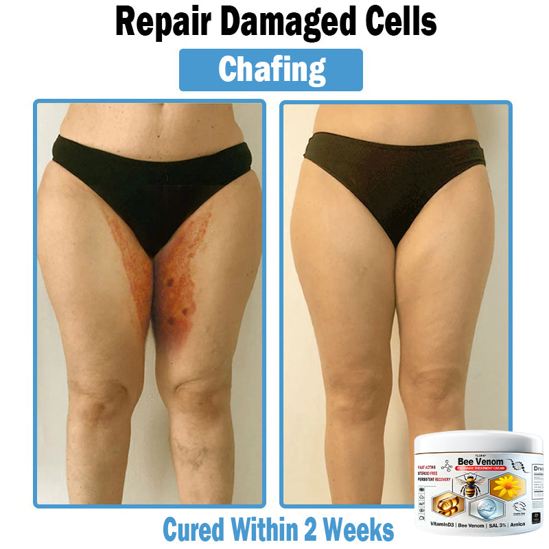 𝙏𝙇𝙊𝙋𝘼®𝑩𝒆𝒆 𝑽𝒆𝒏𝒐𝒎 𝑴𝒖𝒍𝒕𝒊-𝑺𝒚𝒎𝒑𝒕𝒐𝒎 𝑺𝒌𝒊𝒏 𝑻𝒓𝒆𝒂𝒕𝒎𝒆𝒏𝒕 𝑪𝒓𝒆𝒂𝒎 (👨‍⚕𝑵𝑷𝑭 𝑹𝑬𝑪𝑶𝑴𝑴𝑬𝑵𝑫𝑺)👨‍⚕