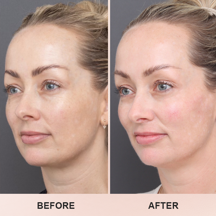 LIMETOW™ Anti-Wrinkle Stick