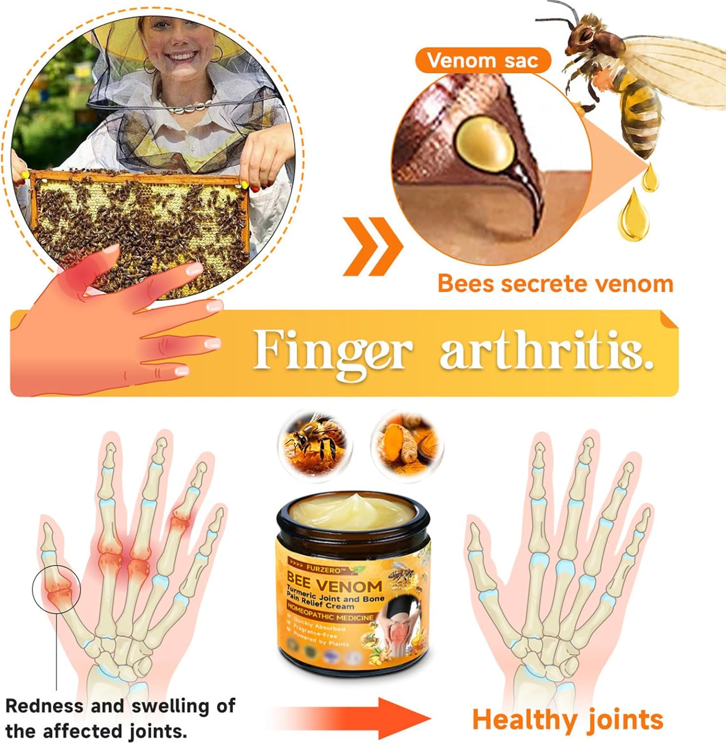 Bee Venom Turmeric Joint and Bone Pain Relief Cream, Professional Bee Venom Joint Therapy Pain Relief Gel, Bee Venom Joint Relief Gel is effective in relieving pain in the back, neck, hands and knees