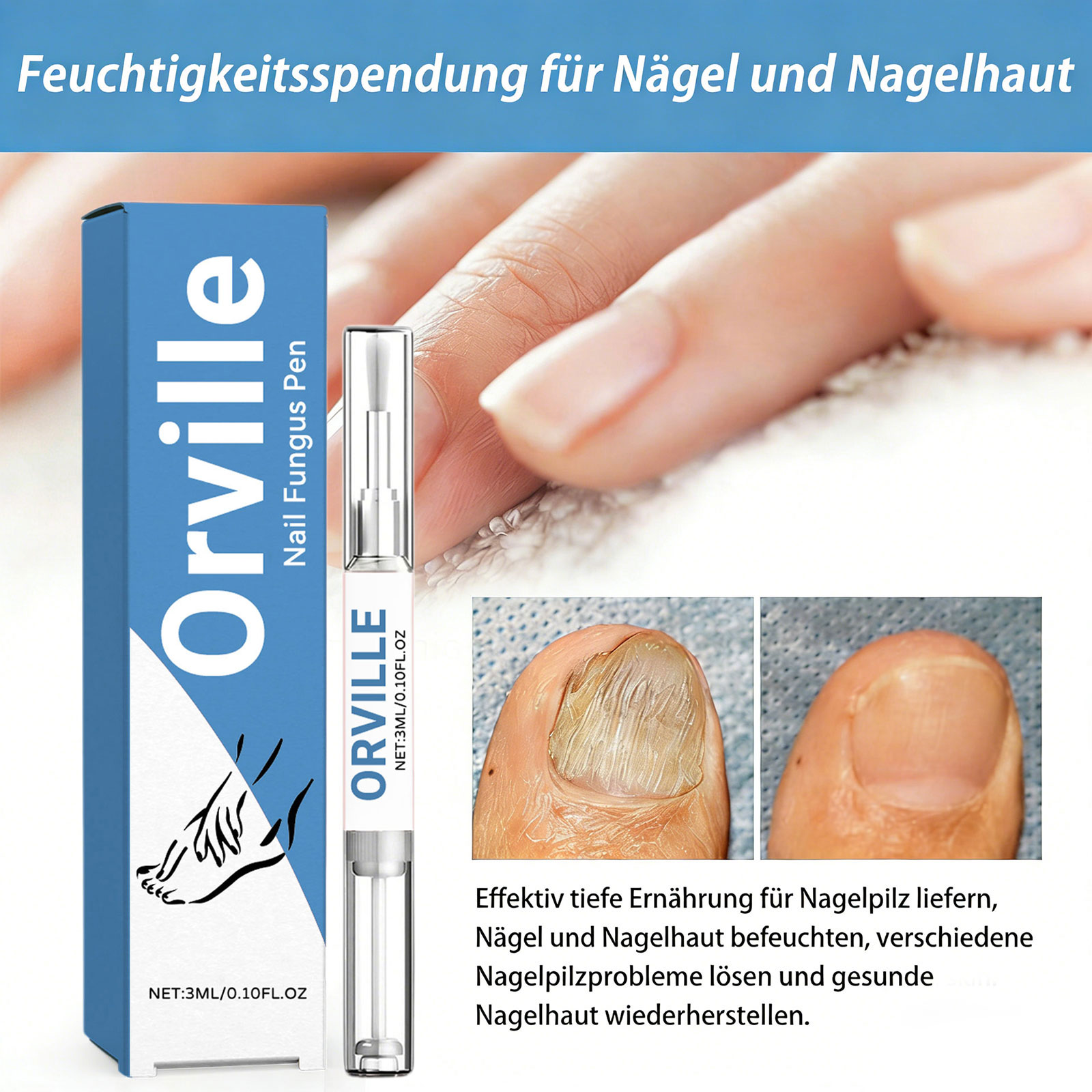 Orville Nagelpilz Stift Original, Natürliches Inhaltsstoffserum für Stärkungsnägel, 2026 Neu Nail Care Pen Nagelpilz für Jeden Geeignet