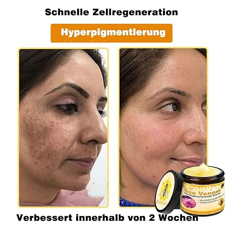 Bienengift Pro Umfassende Creme, Professionelle bienengift Therapie Creme, Ourlyard Bee Venom Hautregenerierende Creme, bienengift cremes, Bienengiftsalbe, für alle Hauttypen