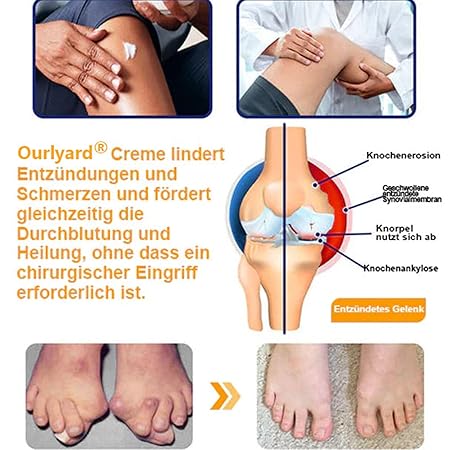 Bienengift-Schmerzlinderungs Knochenheilungs Creme, Professionelle Bienengift Gelenkcreme, Ourlyard Bienengift Gelenkgel, Natürlich Bienengiftsalbe Joint Gel, für Rücken,Nacken,Knie