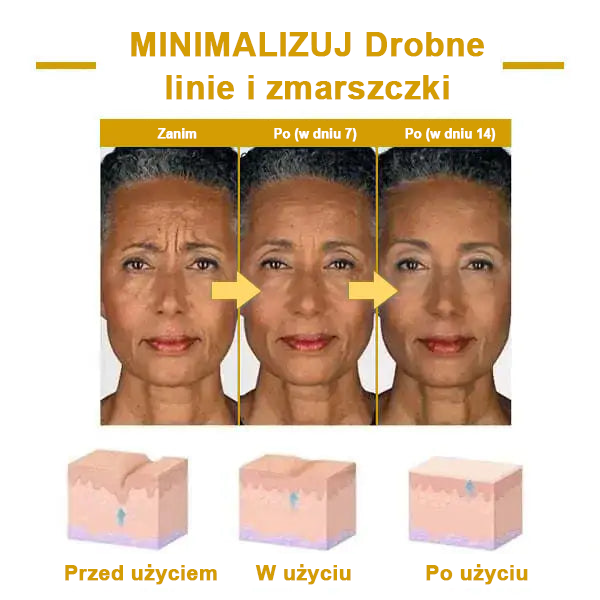 ✨ Zniżka ostatniego dnia: 60% ZNIŻKI🌿𝐅𝐮𝐛𝐬𝐭𝐚® olejek odmładzający ujędrniający skórę💧