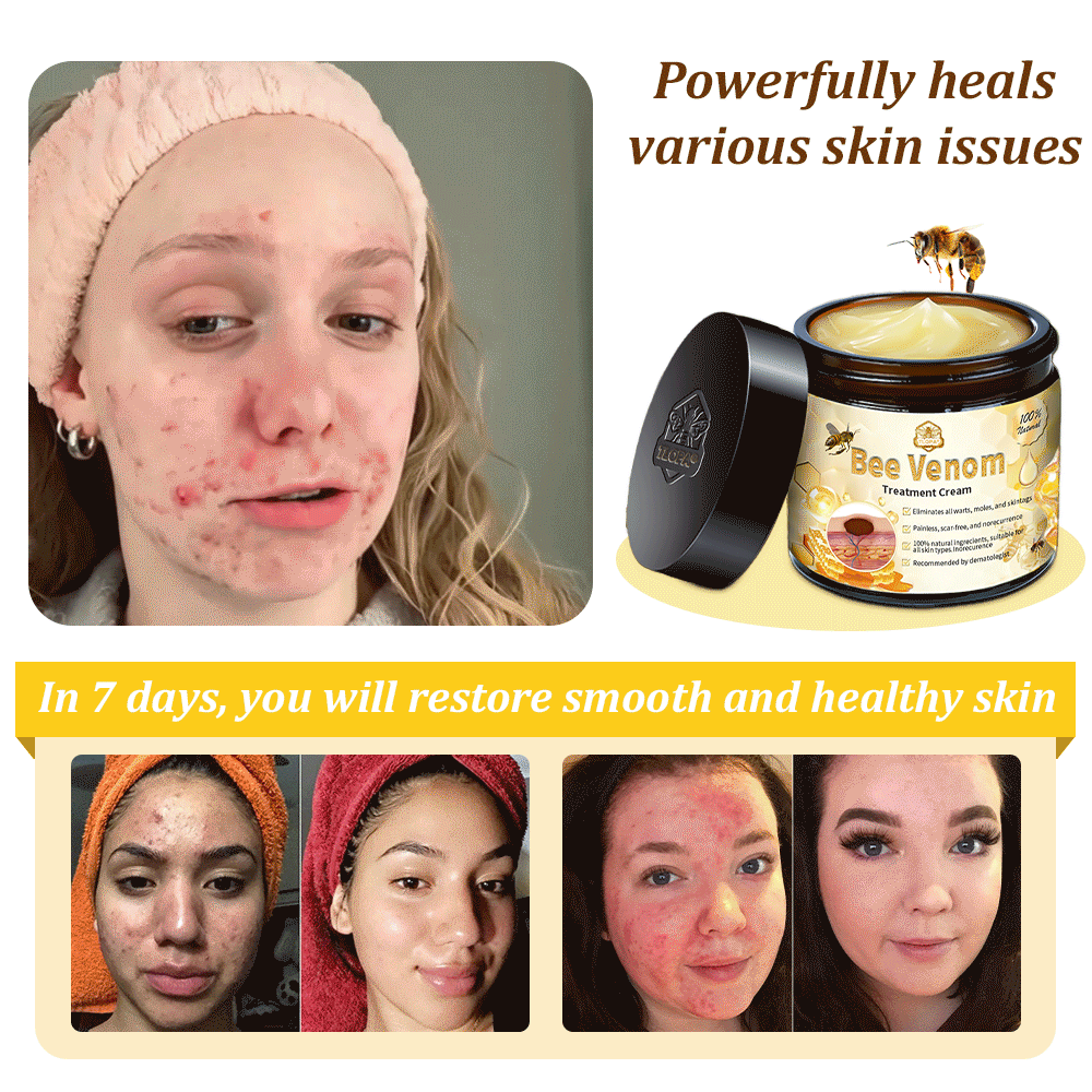 Official Store: TLOPA® Bee Venom Skin Treatment Cream👨‍⚕️British Association of Dermatologists (BAD) Approved⛄🎉
