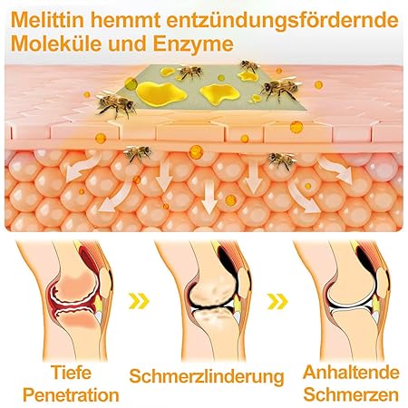 Bienengift-Schmerzlinderungs Knochenheilungs Creme, Professionelle Bienengift Gelenkcreme, Ourlyard Bienengift Gelenkgel, Natürlich Bienengiftsalbe Joint Gel, für Rücken,Nacken,Knie