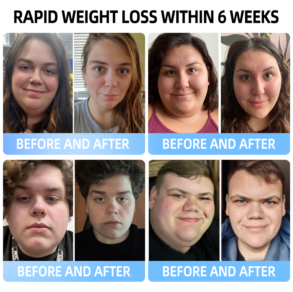 ✅Official Store：TLOPA® 💚𝐌𝐞𝐠𝐥𝐮𝐭𝐢𝐝𝐞 𝐨𝐫𝐚𝐥 𝐥𝐢𝐪𝐮𝐢𝐝 (A food-grade fat-burning product developed by Albert Einstein College of Medicine and highly recommended by USP!)