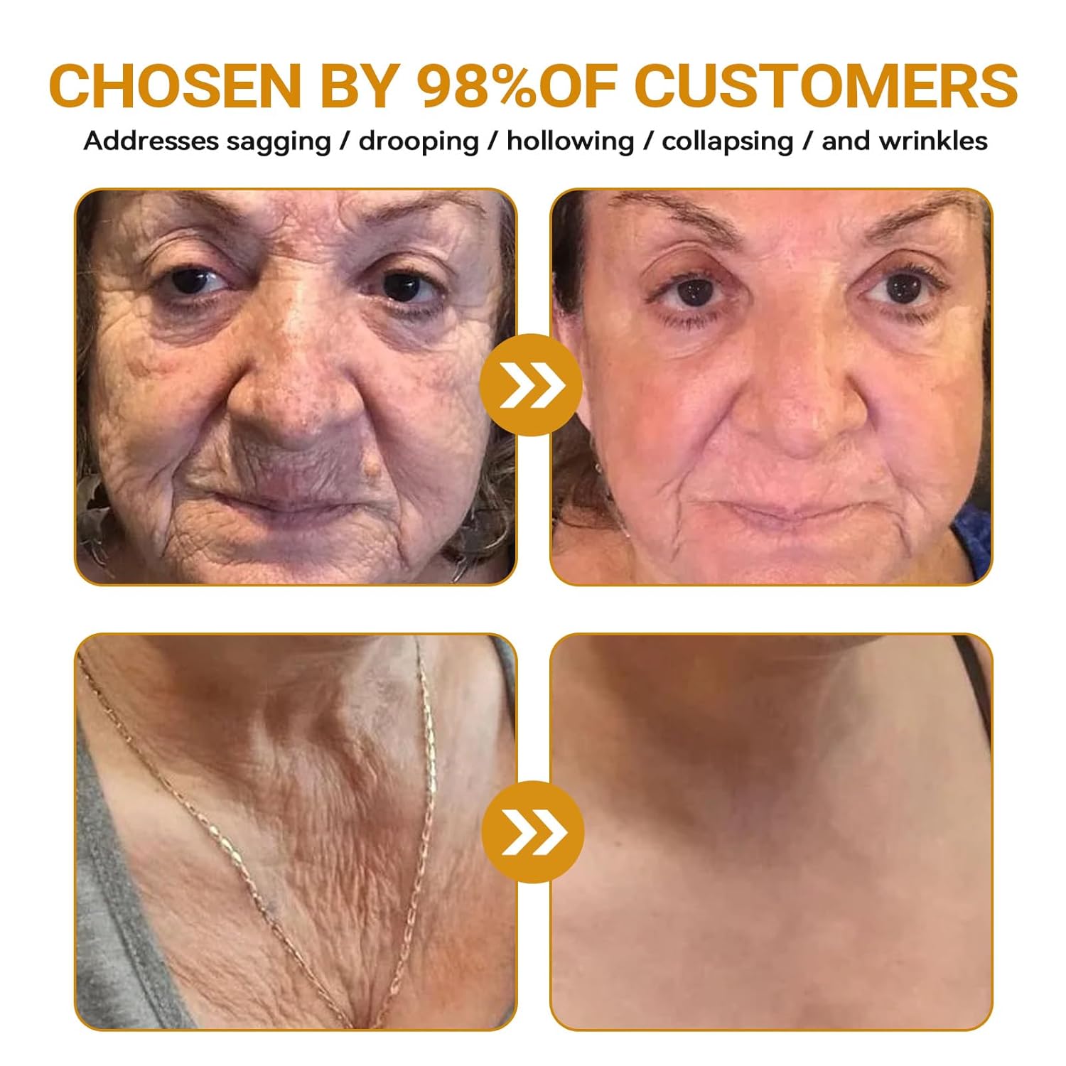 Awzlove Bee Venom Cream, Awzlove Bee Venom Rapid Skin Repair Cream, Bee Venom Skin Treatment cream, Effective In Reducing skin Blemishes, Gentle and Non-irritating for All Types