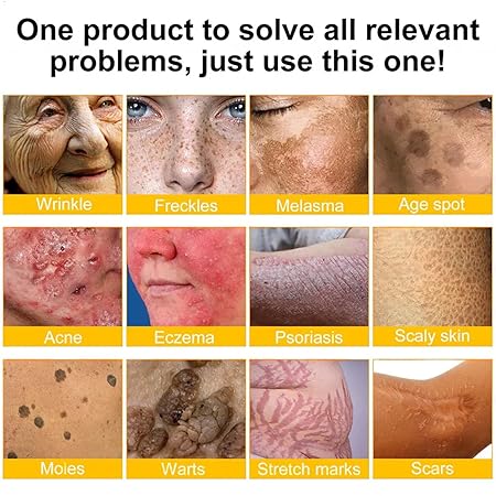 Bienengift Pro Umfassende Creme, Professionelle bienengift Therapie Creme, Ourlyard Bee Venom Hautregenerierende Creme, bienengift cremes, Bienengiftsalbe, für alle Hauttypen