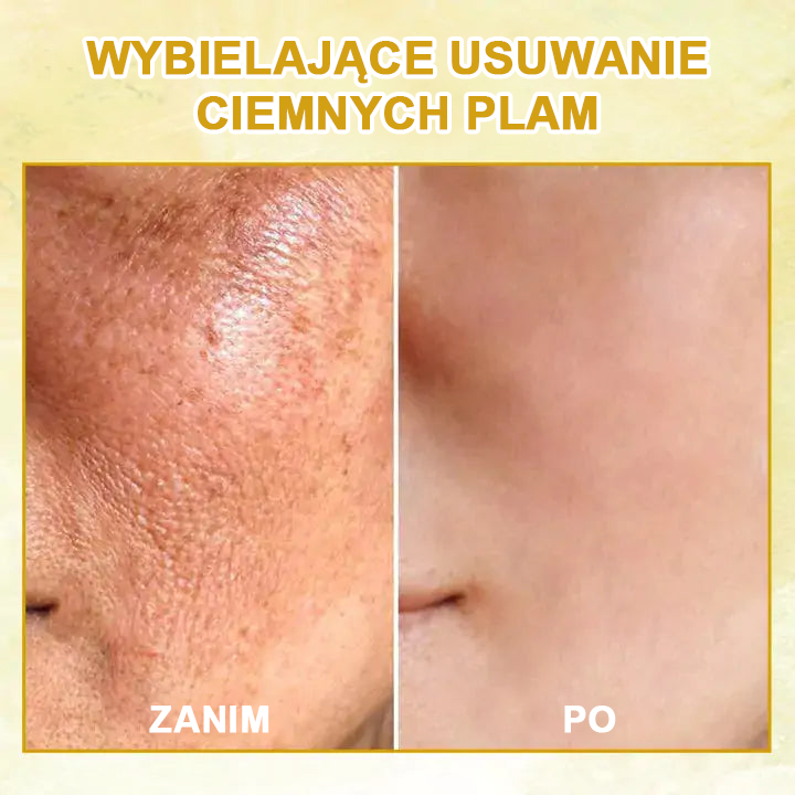 ✨ Zniżka ostatniego dnia: 60% ZNIŻKI🌿𝐅𝐮𝐛𝐬𝐭𝐚® olejek odmładzający ujędrniający skórę💧