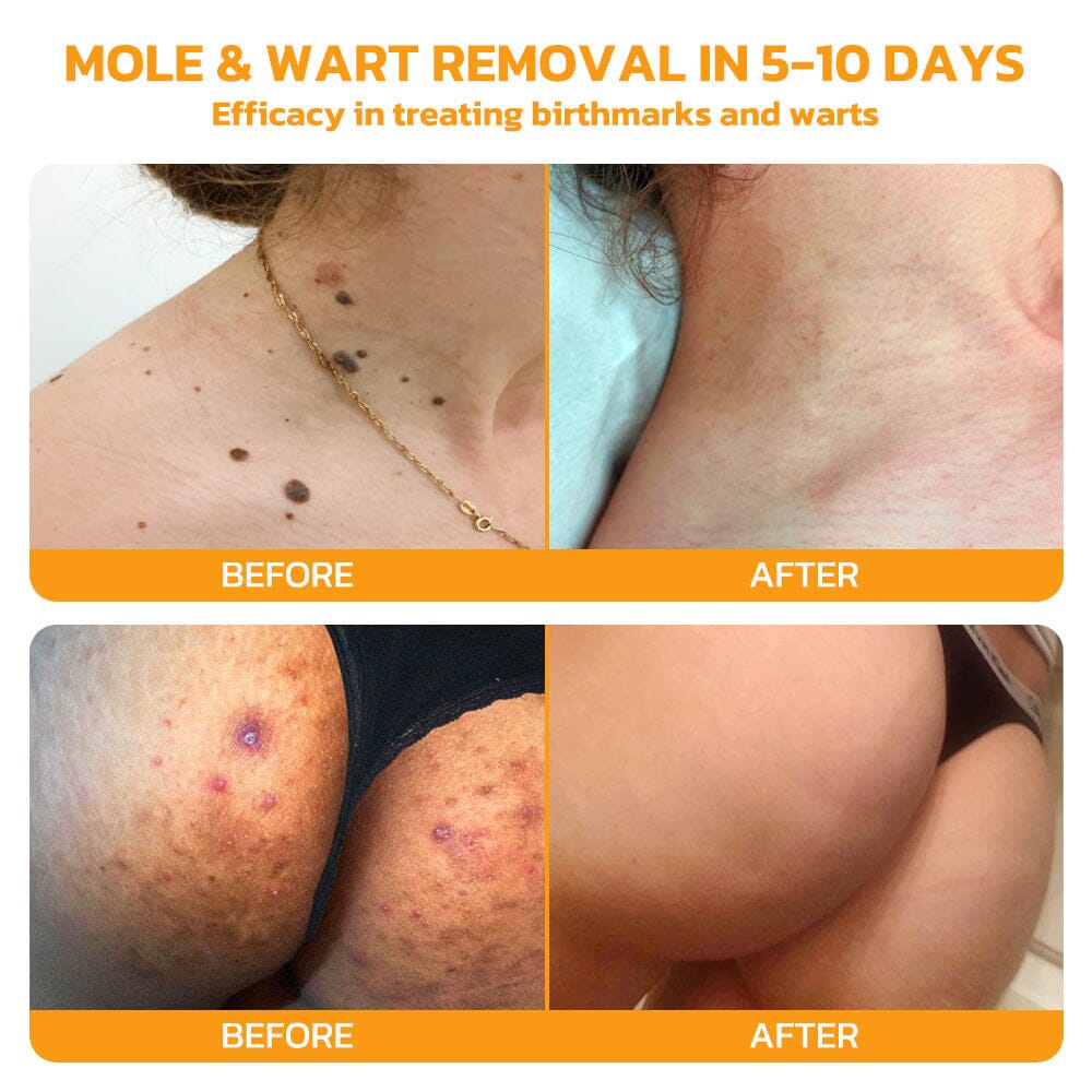 Therapeutic Goods Administration (TGA)✅ Furzero™ Bee Venom Skincare Treatment Pads (⚕️AAD Recommended)