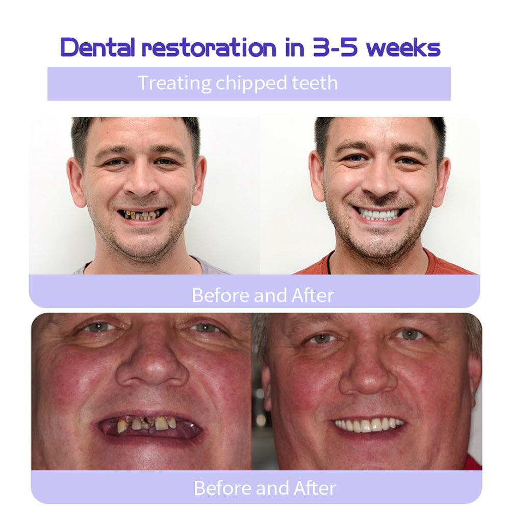Cvreoz® Teeth Restoration Mineral Powder🦷(ADA recommended) (🎁Flash Sale - Don’t Miss Out)🎄✨
