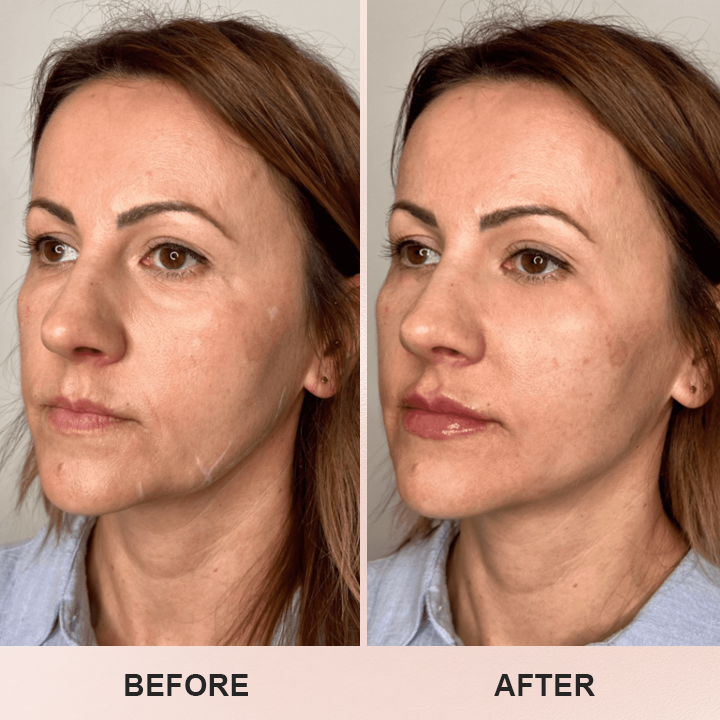 LIMETOW™ Anti-Wrinkle Stick