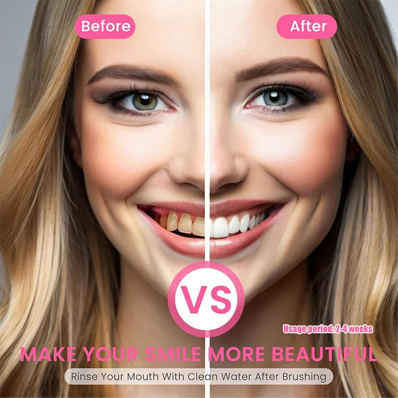 Cvreoz®Niacinamide Whitening Toothpaste-max