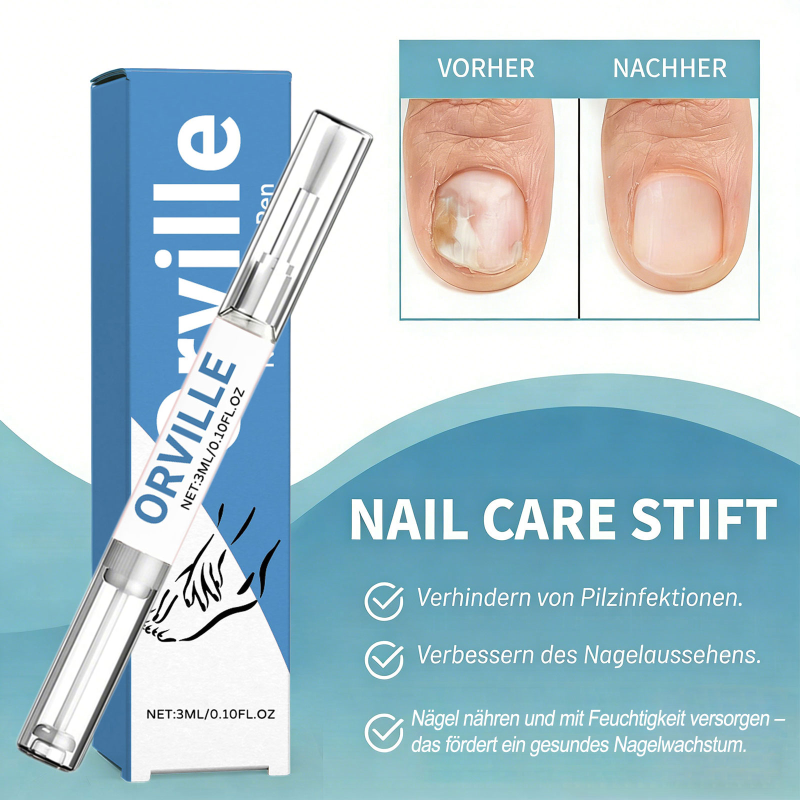 Orville Nagelpilz Stift Original, Natürliches Inhaltsstoffserum für Stärkungsnägel, 2026 Neu Nail Care Pen Nagelpilz für Jeden Geeignet