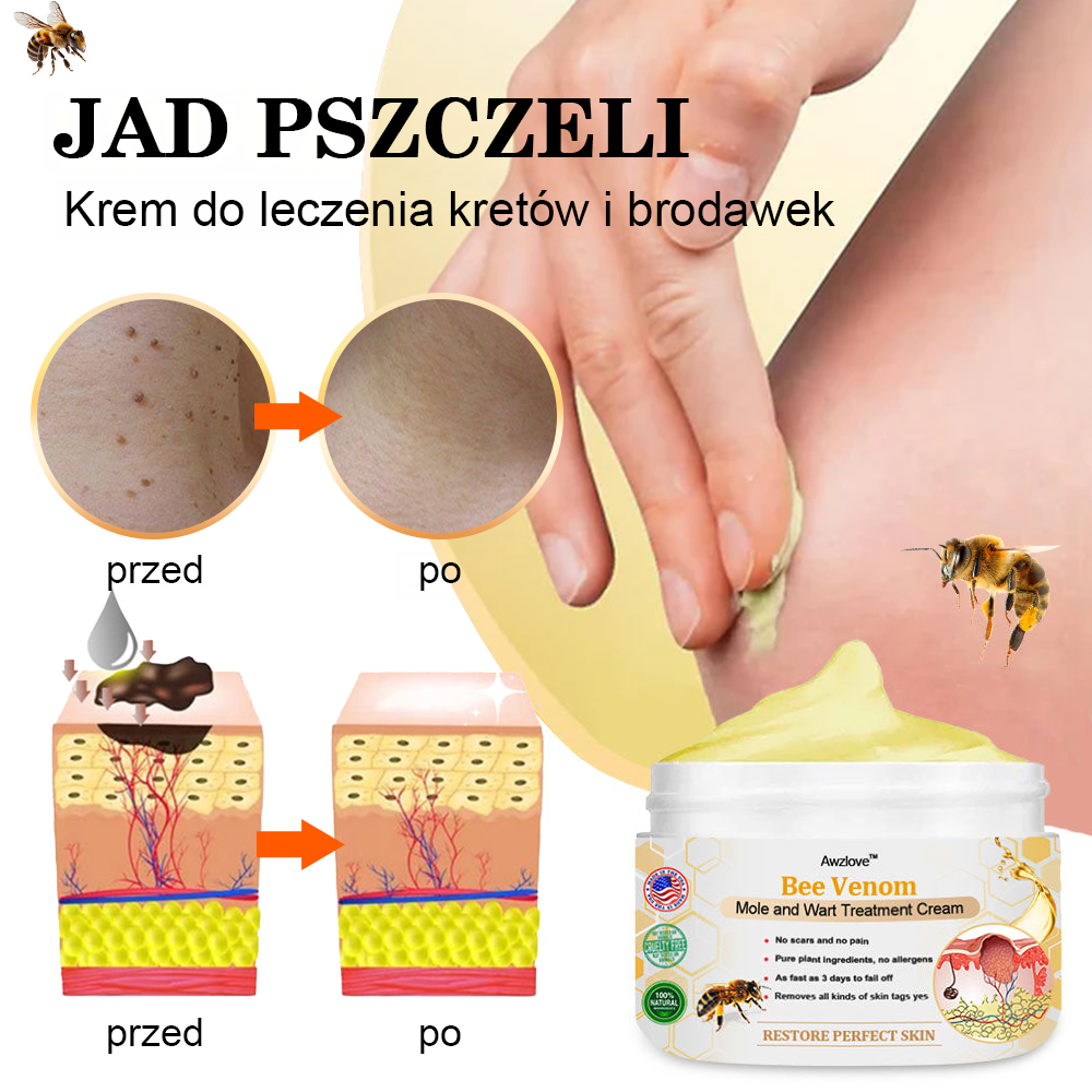[🌟 Za pobraniem 🌟] 𝐀𝐰𝐳𝐥𝐨𝐯𝐞™ Krem leczący znamiona i brodawki z jadem pszczelim (👨‍⚕Zalecenia AAD )
