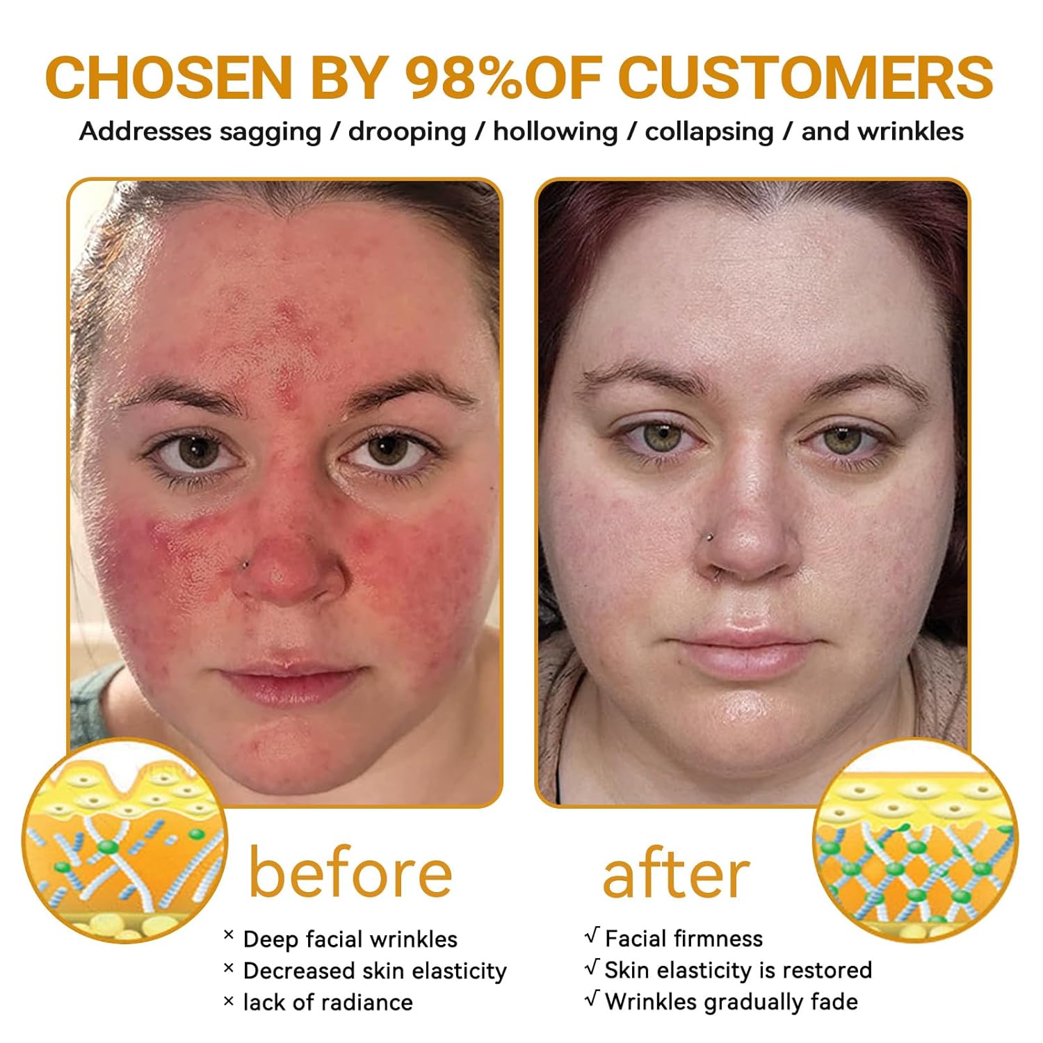 Awzlove Bee Venom Cream, Awzlove Bee Venom Rapid Skin Repair Cream, Bee Venom Skin Treatment cream, Effective In Reducing skin Blemishes, Gentle and Non-irritating for All Types