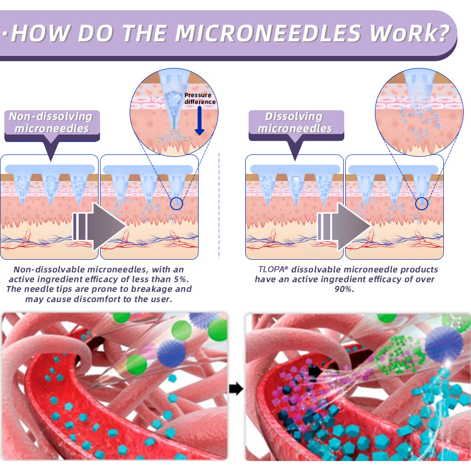 [See results in 7 days]🌹TLOPA® SMGT-GLP-1 Nano Microneedle Patch（Painless, long-lasting, addressing diabetes, obesity, and cardiovascular diseases)🌹