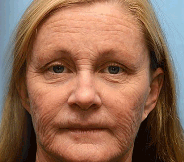 Made and Shipped from the USA TLOPA® Advanced Anti-Wrinkle Firming Cream:✨ Regenerates skin cells, restoring elasticity and firmness-Last Day Promotion 70% OFF👩‍⚕️💐