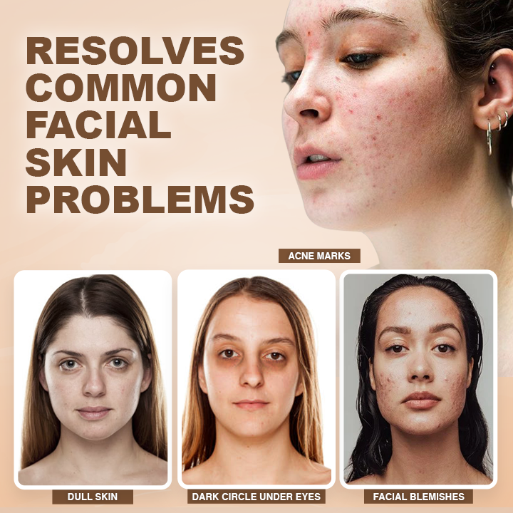 LIMETOW™  Luxury Concealer