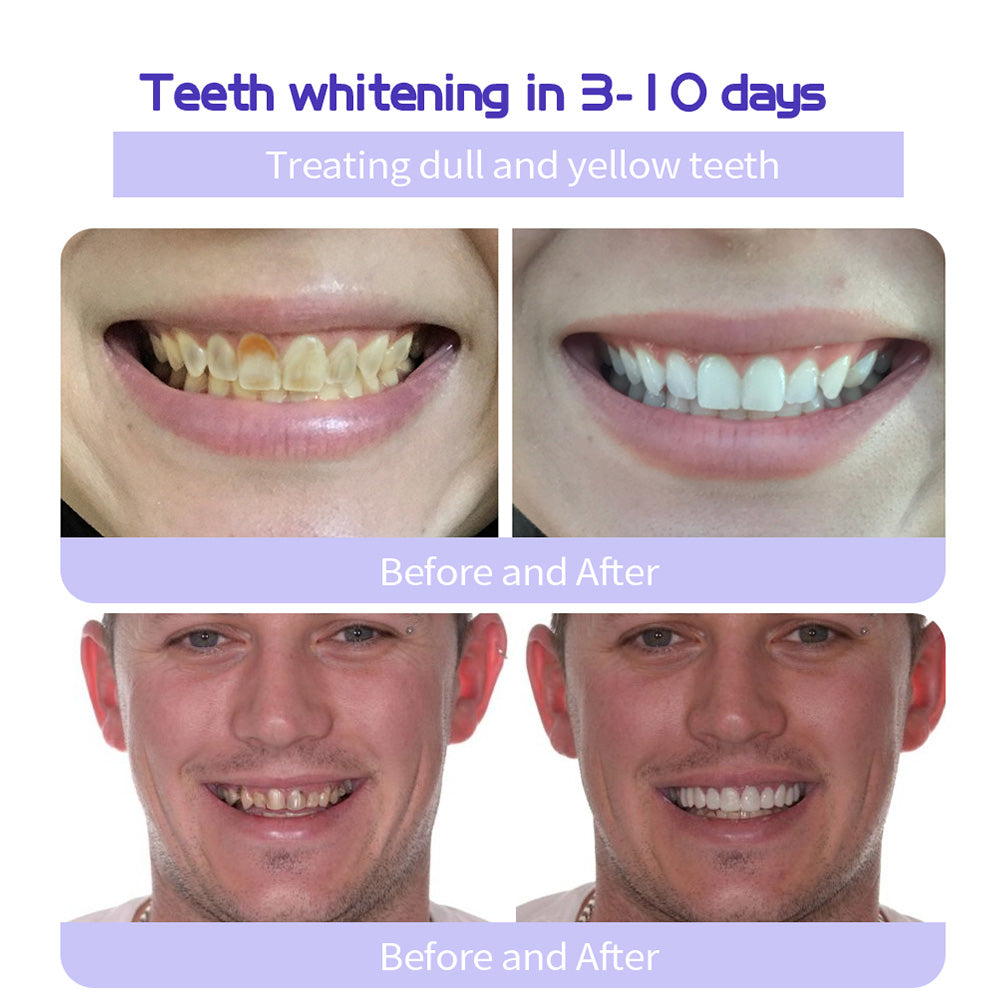 Cvreoz® Teeth Restoration Mineral Powder🦷(ADA recommended) (🎁Flash Sale - Don’t Miss Out)🎄✨