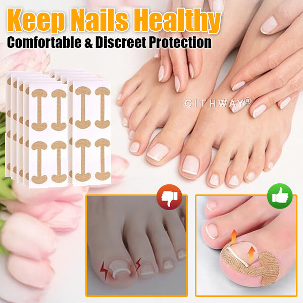 Cithway® Ingrown Toenail Corrector Kit