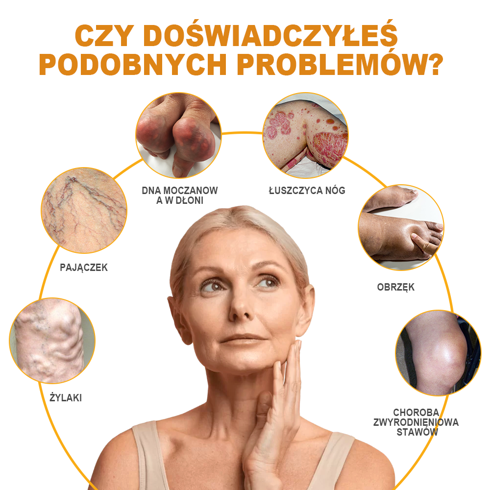 🏆🌈[✨Oficjalny sklep flagowy✨]Zoencgz™ Krem na zapalenie stawów i żylaki z jadem pszczelim