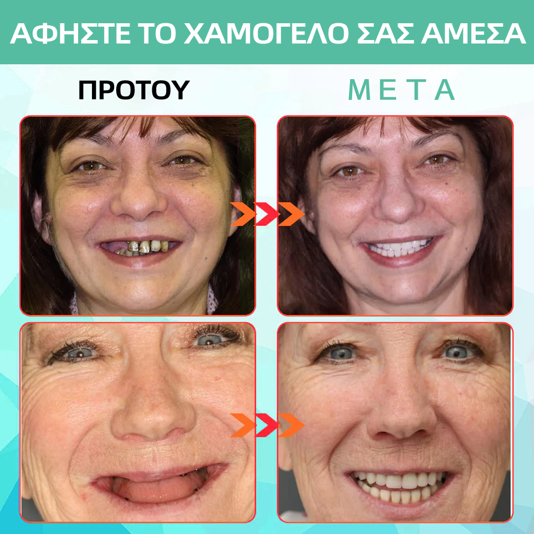 𝐁𝐢𝐤𝐞𝐧𝐝𝐚® 𝐒𝐢𝐥𝐢𝐜𝐨𝐧𝐞 𝐑𝐞𝐥𝐢𝐧𝐞 𝐃𝐞𝐧𝐭𝐮𝐫𝐞 𝐒𝐞𝐭 (🦷𝐋𝐢𝐦𝐢𝐭𝐞𝐝 𝐭𝐢𝐦𝐞 𝐝𝐢𝐬𝐜𝐨𝐮𝐧𝐭 𝐋𝐚𝐬𝐭 𝟑𝟎 𝐦𝐢𝐧𝐮𝐭𝐞𝐬🦷)🍀