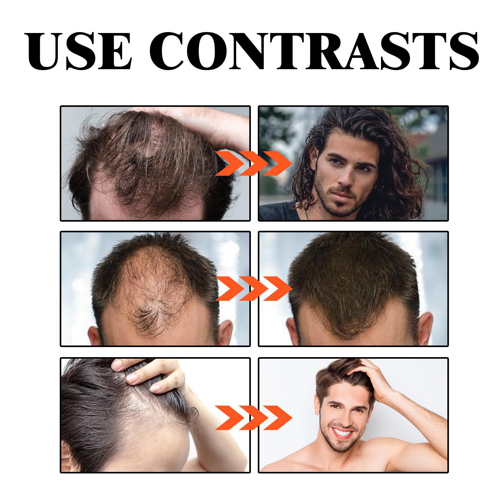 Dobshow Premium Biotin Hair&Beard Booster, 2024 New Upgrade Biotin Hair Serum Spray for Hair And Beard