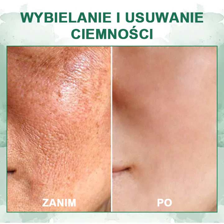 🌿💝Ostatni dzień promocji 60% Zniżki - Fubsta™ Serum odmładzające ujędrniające skórę🔥