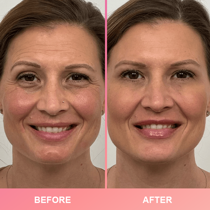 LIMETOW™ Compact Anti-Wrinkle Bar