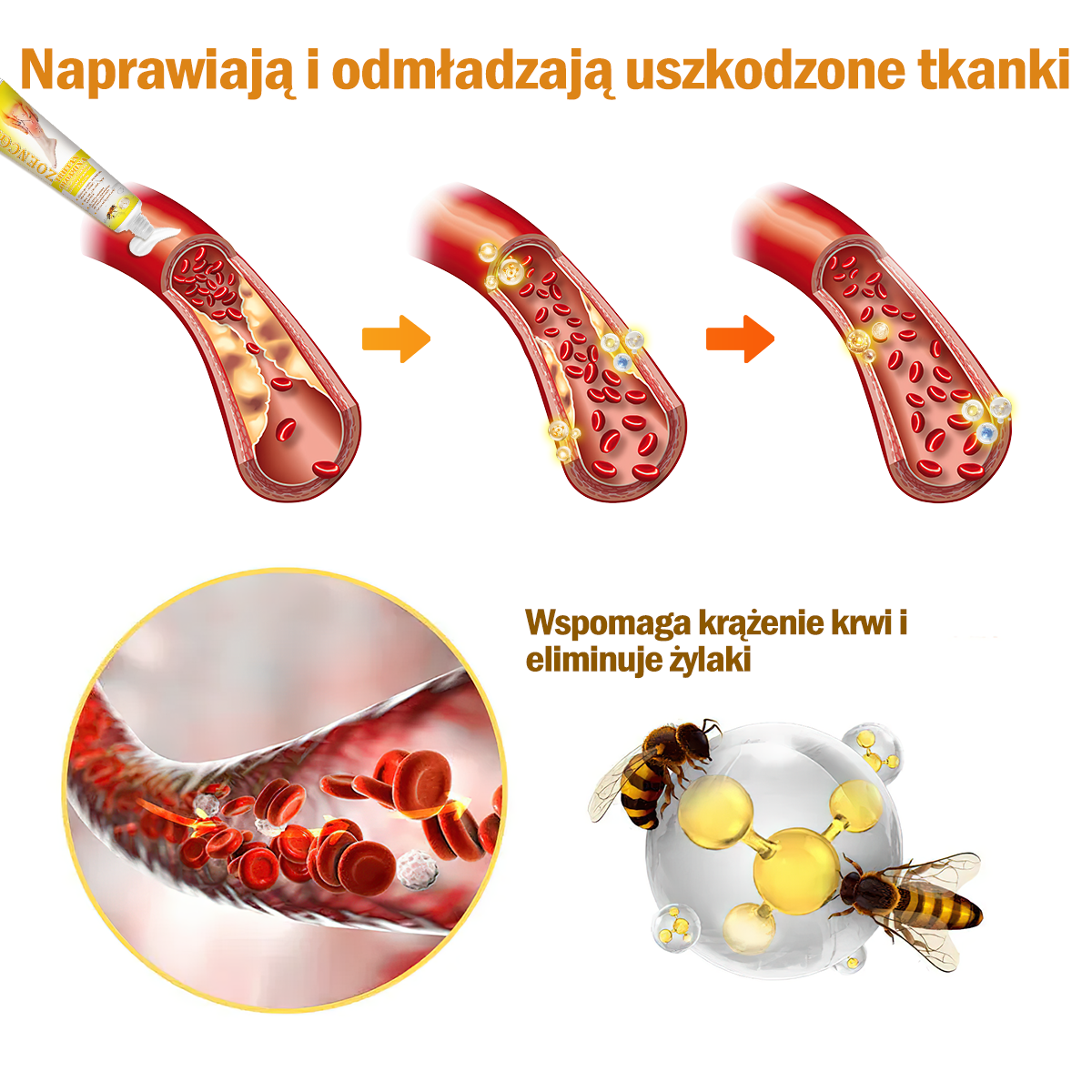 🏆🌈[✨Oficjalny sklep flagowy✨]Zoencgz™ Krem na zapalenie stawów i żylaki z jadem pszczelim