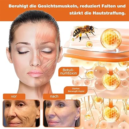 Bienengift Pro Umfassende Creme, Professionelle bienengift Therapie Creme, Ourlyard Bee Venom Hautregenerierende Creme, bienengift cremes, Bienengiftsalbe, für alle Hauttypen