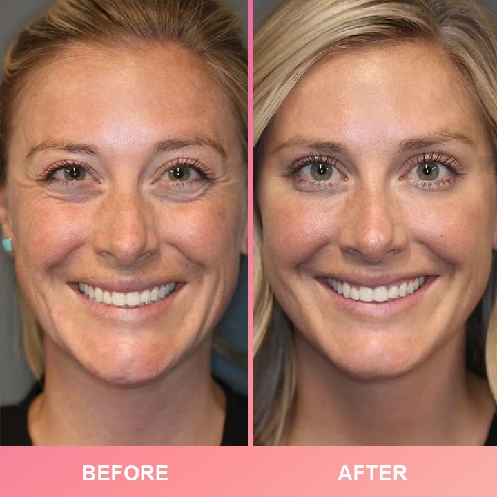 LIMETOW™ Compact Anti-Wrinkle Bar