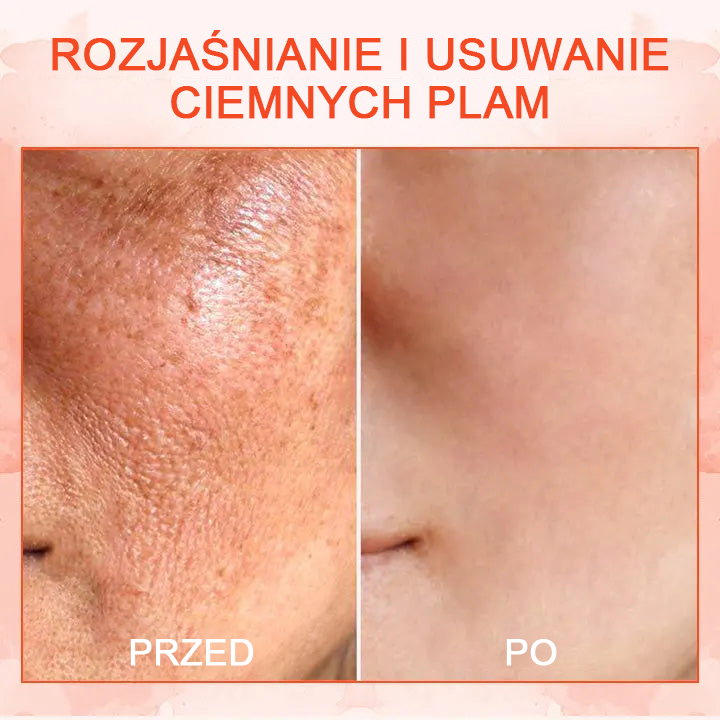 🌠 70% Rabaty ✨𝗖𝗼𝗼𝗹𝗼𝗿𝗱® - 𝐋𝐮𝐱𝐞𝐋𝐢𝐟𝐭 Ujędrniający i tonizujący krem do ciała✨