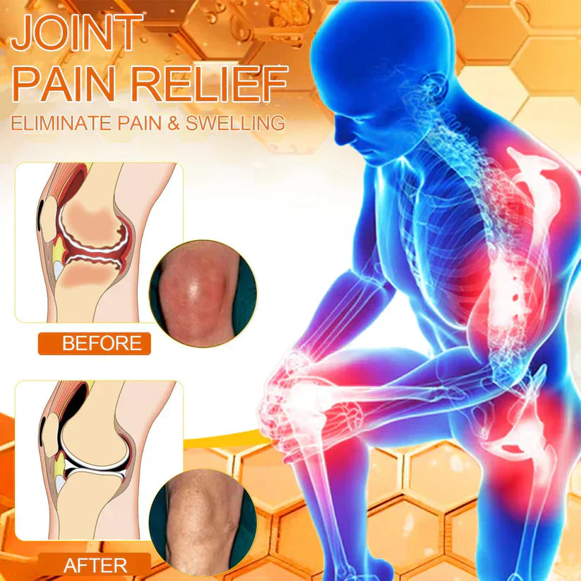 Official Store: TLOPA® Bee-Venom Pain-Relief Bone Healing Cream👨‍⚕️USA Osteopathic Medical Association (AAOS) Approved(Reducing joint swelling, pain, stiffness, redness, warmth, soreness, and joint fatigue)
